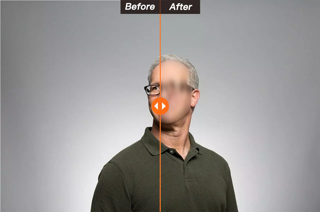 Avant et après la désensibilisation du visage par la photo
