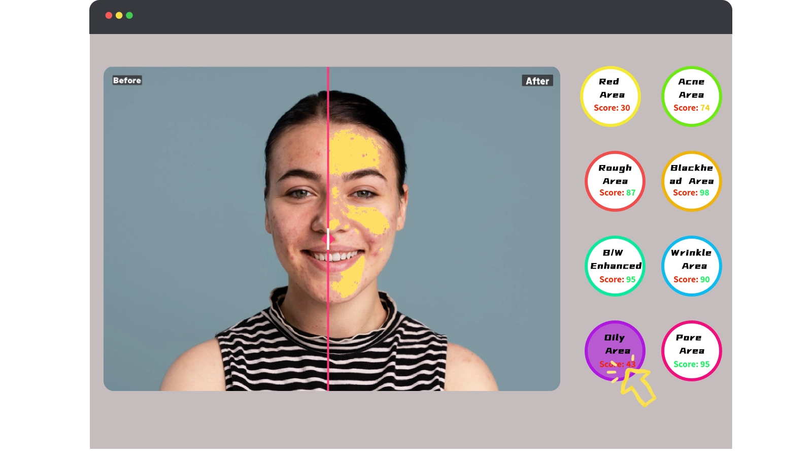 AI skin analyzer