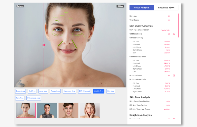 Desktop Skin Analysis Device for Beauty Salons: A Practical Integration ...